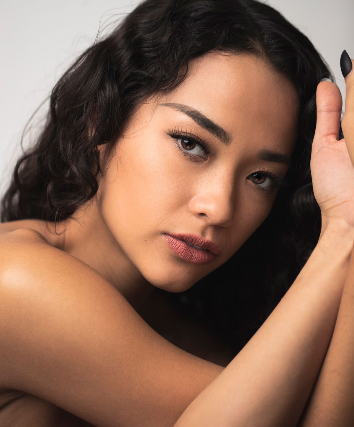 Vancouver lower blepharoplasty patient model