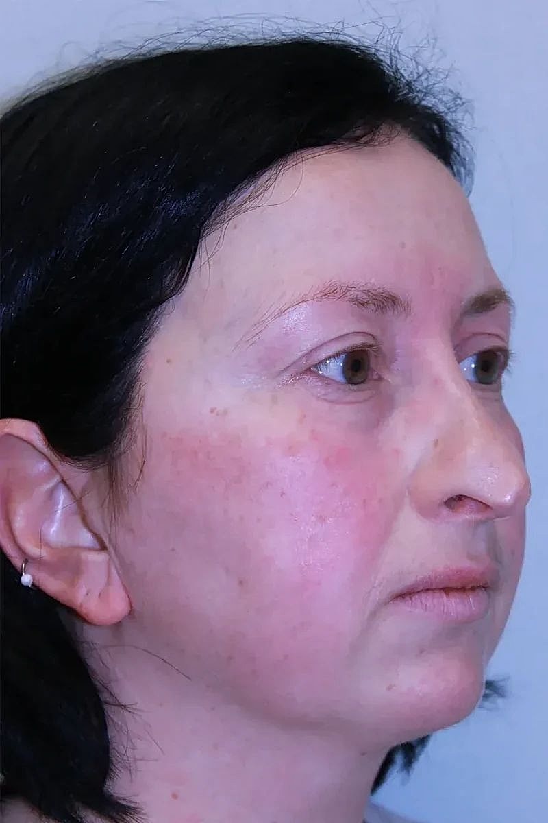 Profile portrait of a woman with dark hair.