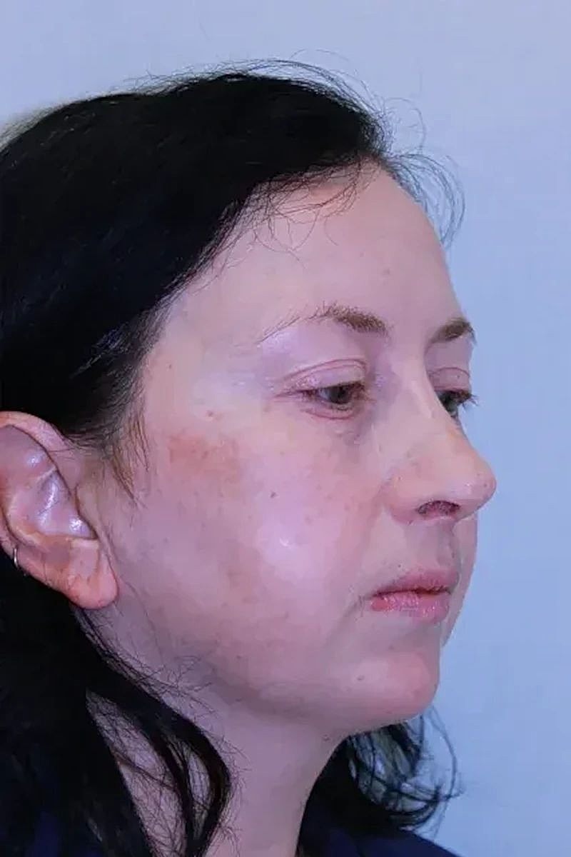 Profile view of a woman with dark hair.