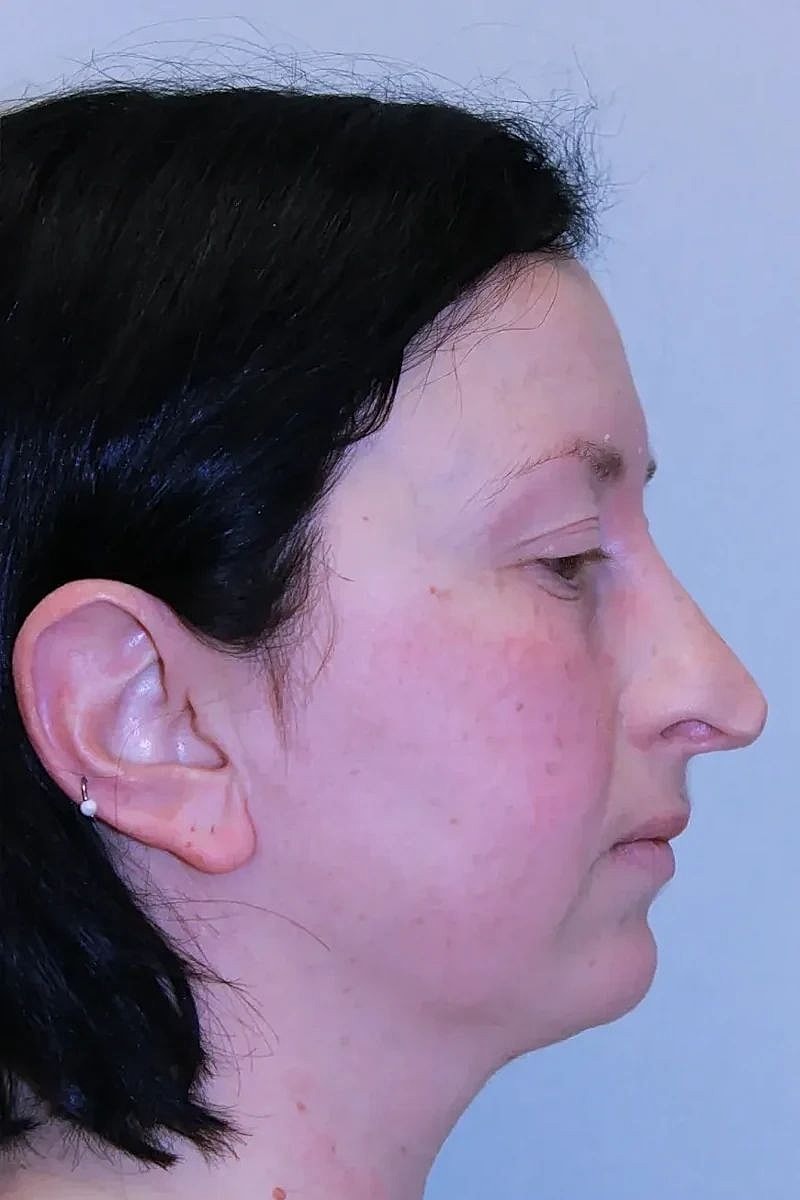 Profile view of a woman with dark hair.