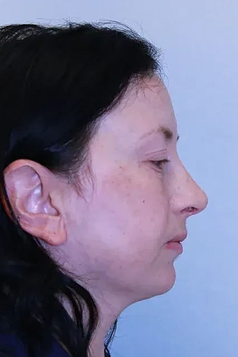 Profile view of a woman with dark hair.