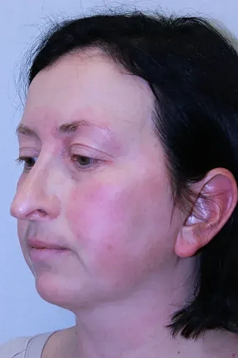 Profile view of a woman with fair skin.