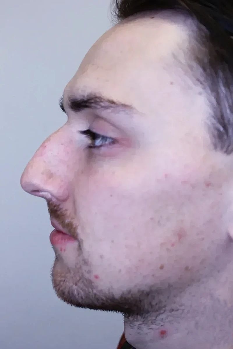 Profile view of a man with facial features.