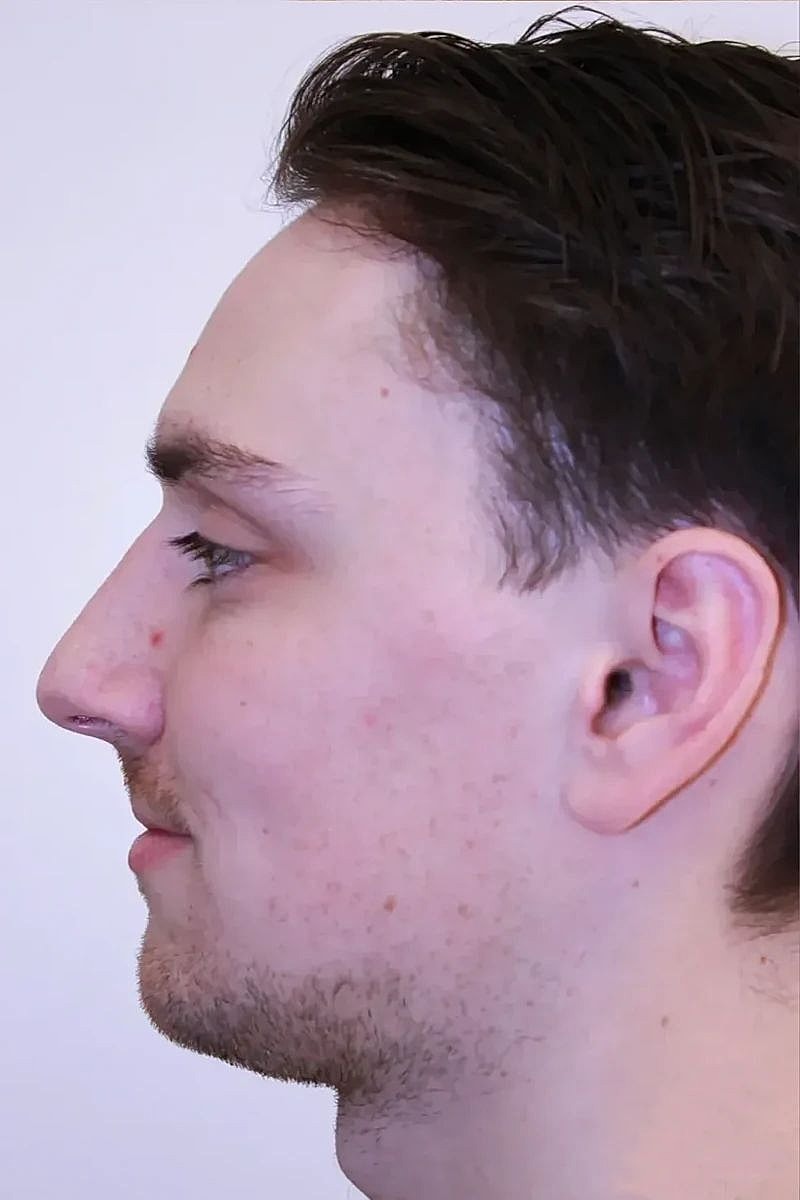 Side profile of a young man with hair.