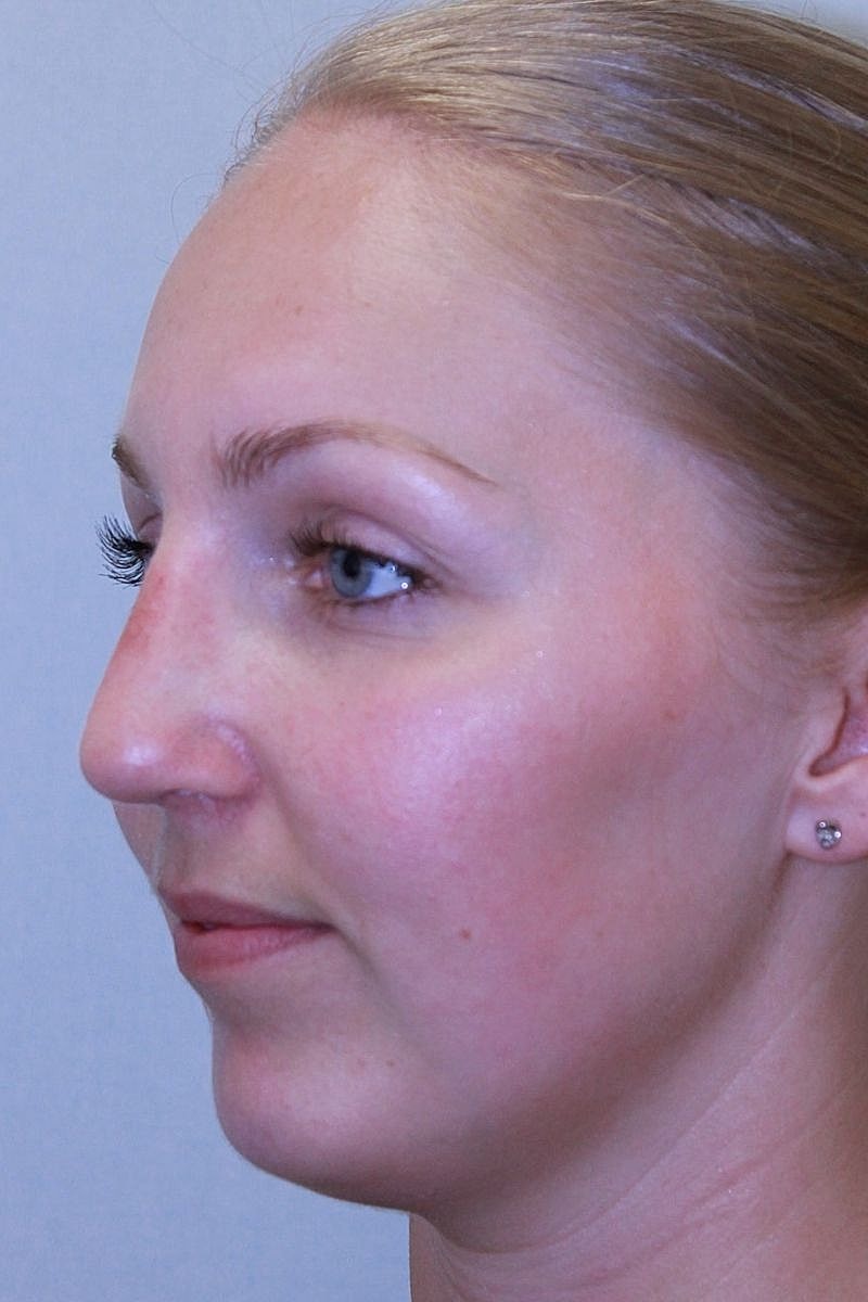 Profile of a woman with blue eyes and blonde hair.