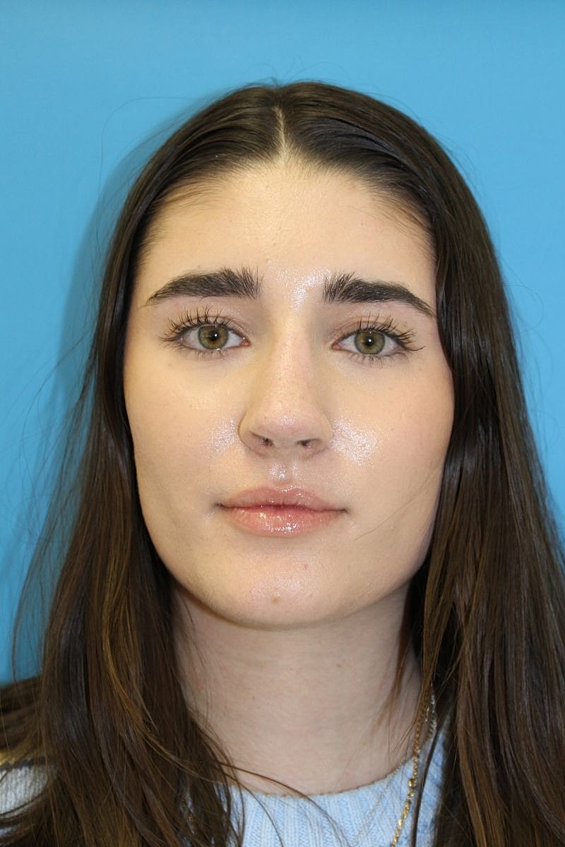 Close-up portrait of a young woman.