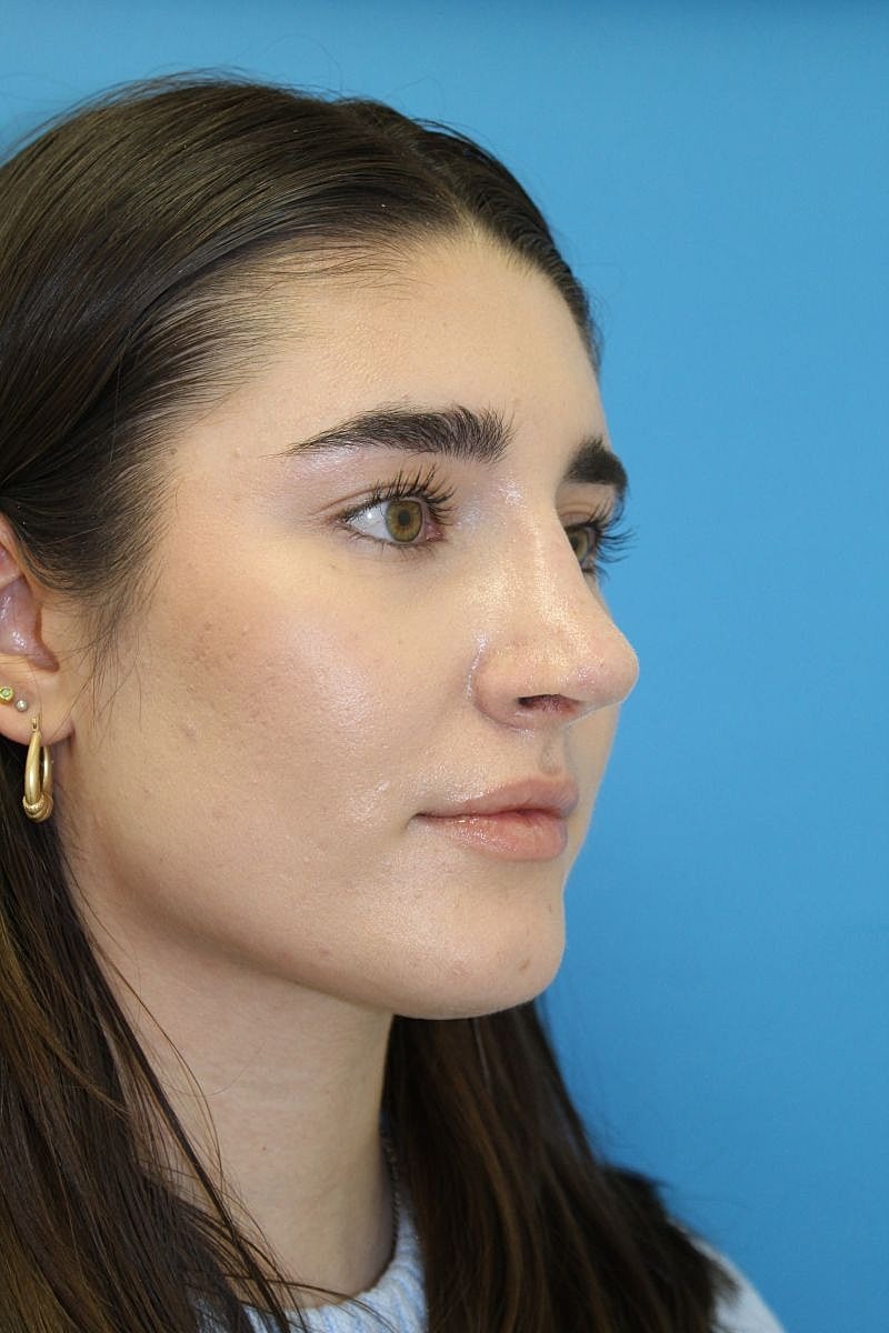 Profile view of a woman against a blue background.
