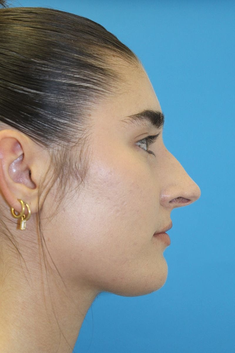 Profile view of a woman against blue background.
