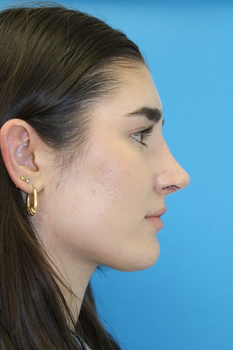 Profile view of a woman against blue background.