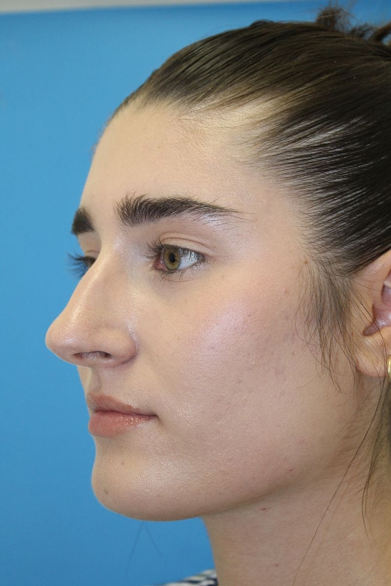 Profile view of a woman with natural makeup.