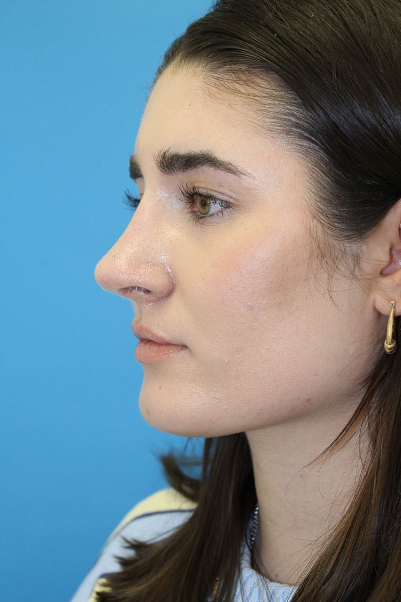 Profile view of a woman with light skin.