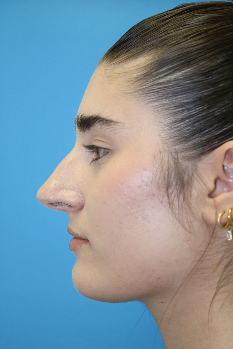 Profile view of a person against blue background.