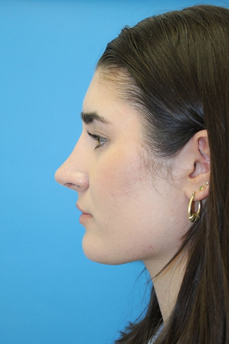 Profile of a young woman against a blue background.