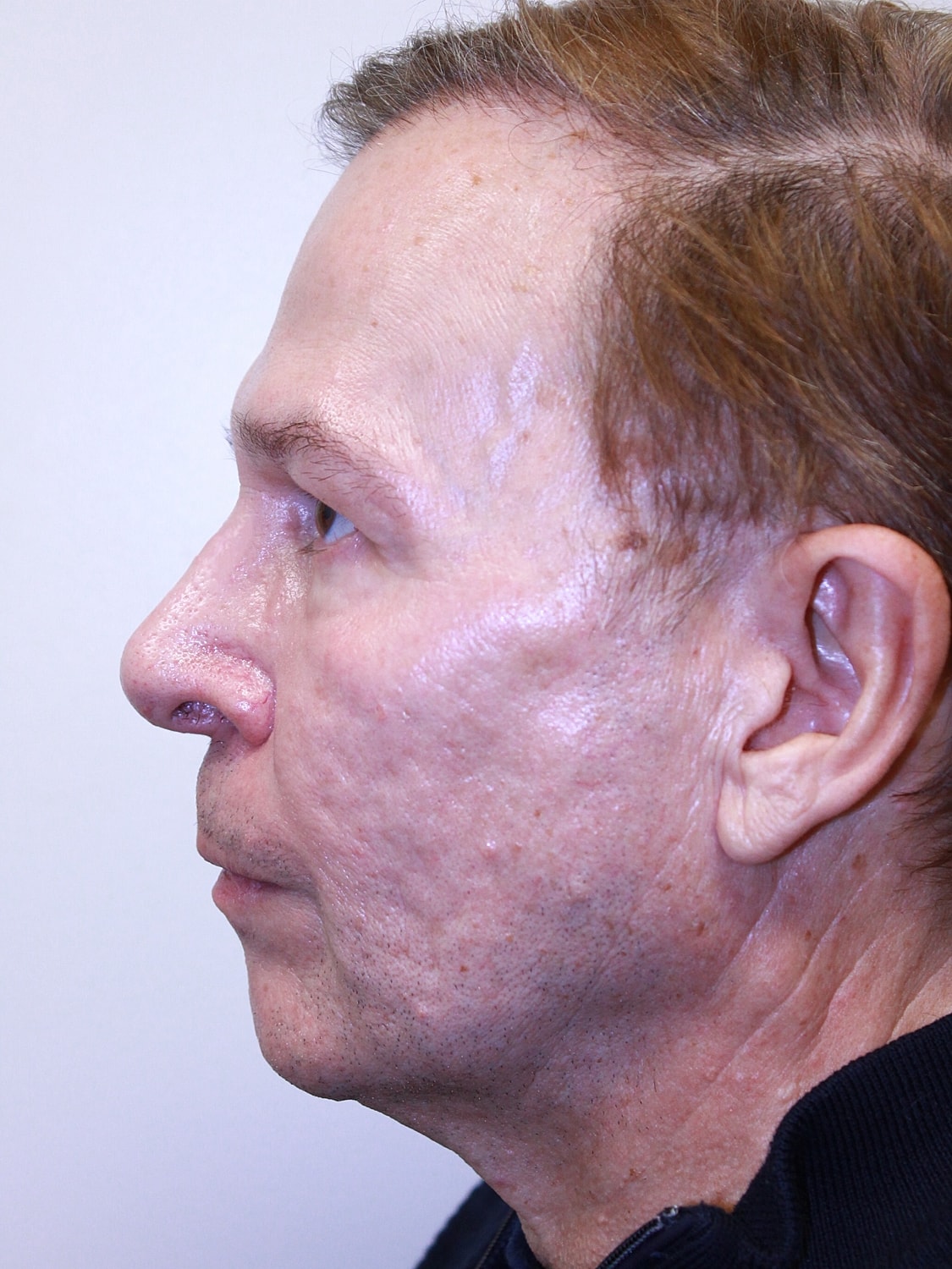 Profile view of a man with short hair.