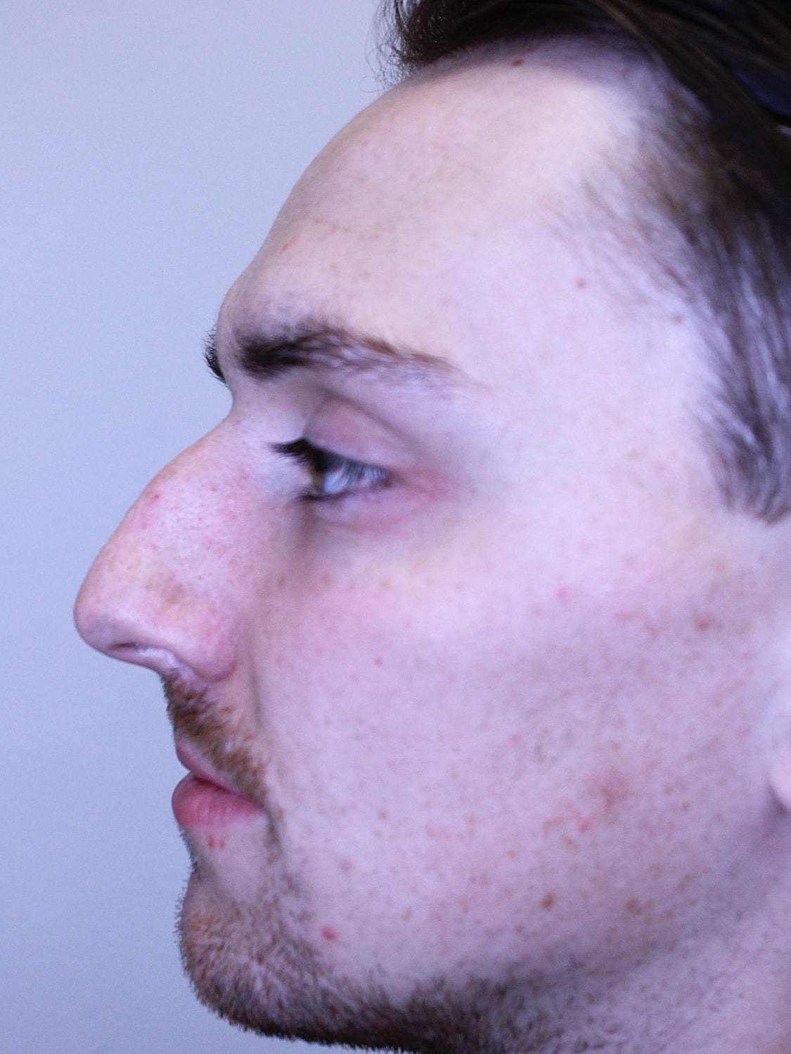 Profile view of a man with facial features.